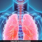 74f42r2o copd 625x300 21 November 18 e7nFil