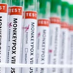 Indian Researchers Find Method To Decode Monkeypox Virus, Aid Diagnostics