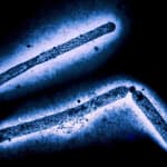 US Reports First Severe Infection Of Bird Flu In A Human