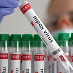 Mpox In China: Cluster Of New Mutated Strain Detected; Know Symptoms And Complication