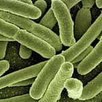 Tanzania Confirms New Outbreak Of Marburg Virus