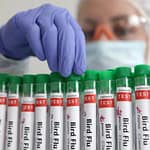 Bird Flu Outbreak In Maharastra’s Village: Know Symptoms And Prevention Tips For H5N1 Virus