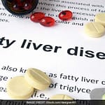 These Herbs Can Help In Fatty Liver Management