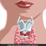 Feeling Tired? These Food Items Can Cure Hypothyroidism