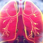 Lung Cancer Cases In Never-Smokers On The Rise: Lancet Study