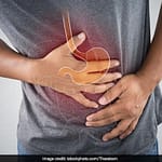 Oesophageal Cancer: Reduce Your Risk By Following These Hacks To Cure Acid Reflux