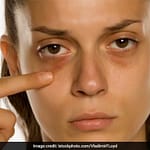 Lifestyle Coach Reveals What Causes Dark Circles Under Your Eyes