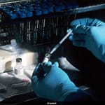 What Is Lassa Fever? Symptoms And How It Spreads